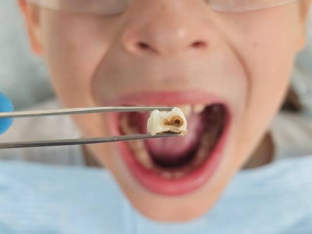 Best Emergency Cosmetic Dentistry (e.g., broken veneers) in Lake Dalecarlia, IN